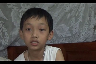 Phụ huynh tố thầy hiệu trưởng đánh học sinh bầm tím mặt