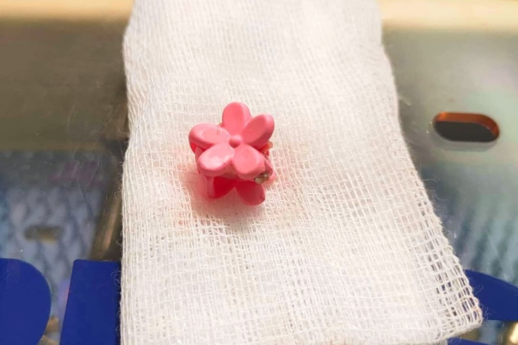 Bé gái ra dịch mủ âm đạo 6 tháng trời vì thứ không ngờ mắc kẹt ở vùng kín - 2 Bé gái ra dịch mủ âm đạo 6 tháng trời vì thứ không ngờ mắc kẹt ở vùng kín - 2