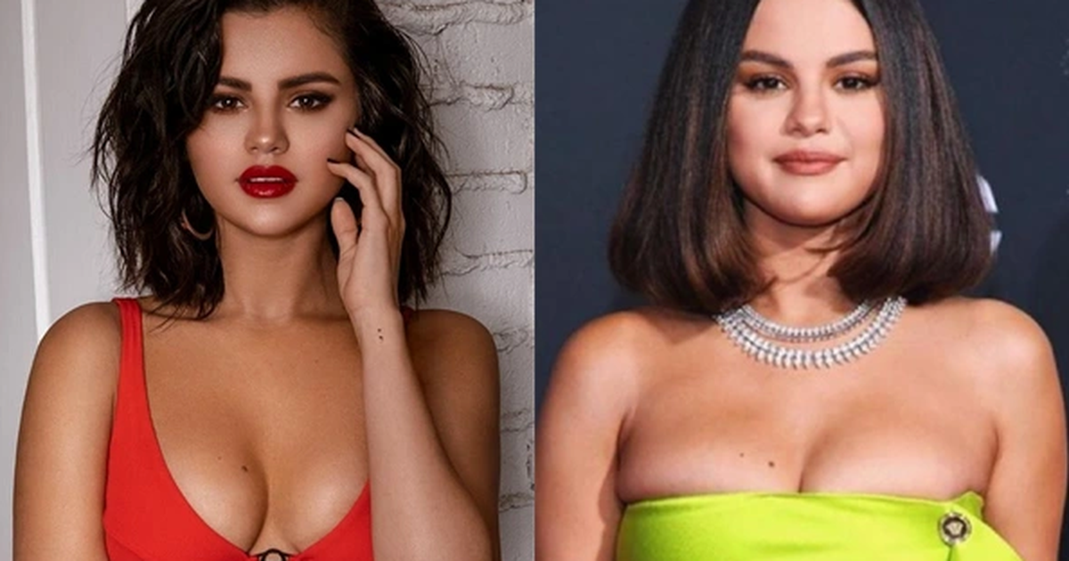 Selena Gomez: Xinh đẹp nhưng khổ sở cả tinh thần, thể xác vì bệnh tật | Báo  Dân trí