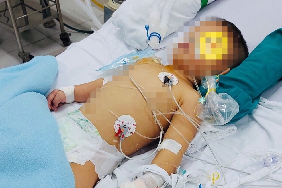 Té vào xô nước ở nhà, bé 14 tháng tuổi ngưng tim, ngưng thở, tổn thương não - 1 Té vào xô nước ở nhà, bé 14 tháng tuổi ngưng tim, ngưng thở, tổn thương não - 1