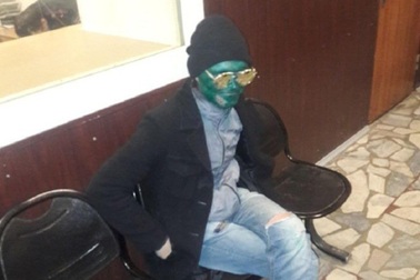 Tên trộm ngu ngốc: Sơn mặt xanh lá cây để ngụy trang trước khi đi móc túi