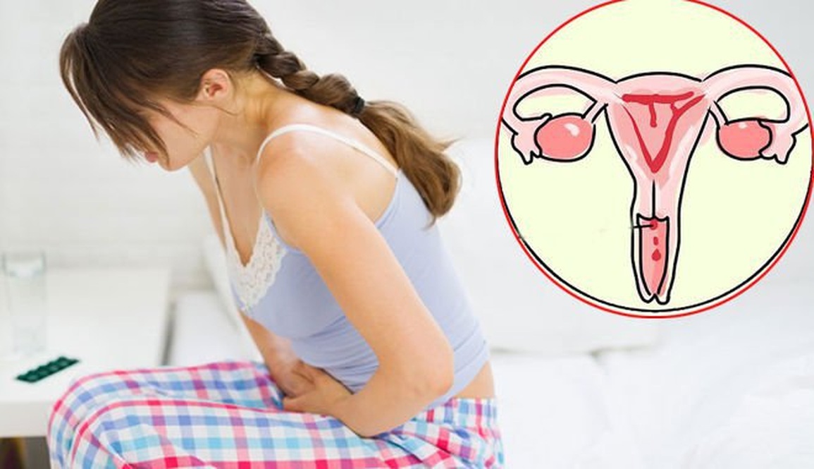 Lạc nội mạc tử cung có làm tăng nguy cơ ung thư? - 1 Lạc nội mạc tử cung có làm tăng nguy cơ ung thư? - 1