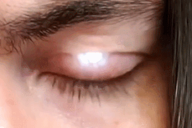 Người đàn ông gắn đèn LED vào mắt để biến mình thành "robot sinh học"