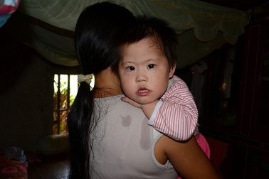 Ánh mắt đáng thương của bé 3 tuổi mắc bệnh tim bẩm sinh