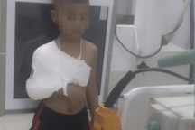 Cần làm rõ vụ trẻ mầm non bị gãy xương đòn khi rời lớp học