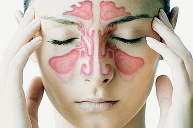 Đau vùng trán kéo dài- triệu chứng sớm của bệnh ung thư dễ bị bỏ sót