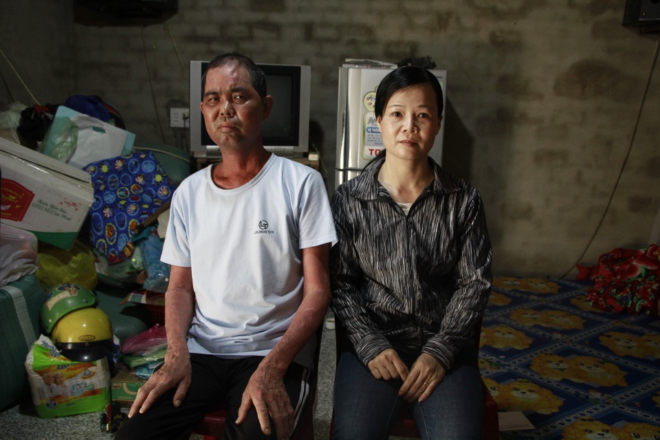 Người đàn ông không dám cựa mình vì sợ da nứt toác được bạn đọc giúp đỡ - 2 Người đàn ông không dám cựa mình vì sợ da nứt toác được bạn đọc giúp đỡ - 2