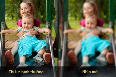 Nhận diện kiểu nhìn mờ đe dọa mù lòa