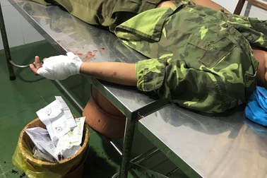 Hàng chục lâm tặc hung hãn vây chém kiểm lâm, giải cứu đồng bọn