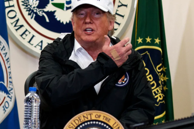 Miếng băng vết thương trên tay ông Trump gây xôn xao