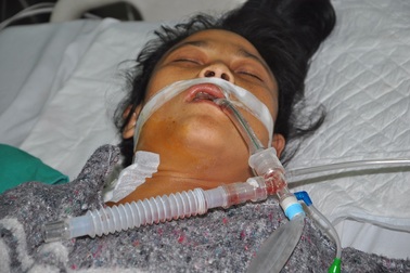 Đang mang thai mười sáu tuần, sản phụ nguy kịch vì suy gan cấp