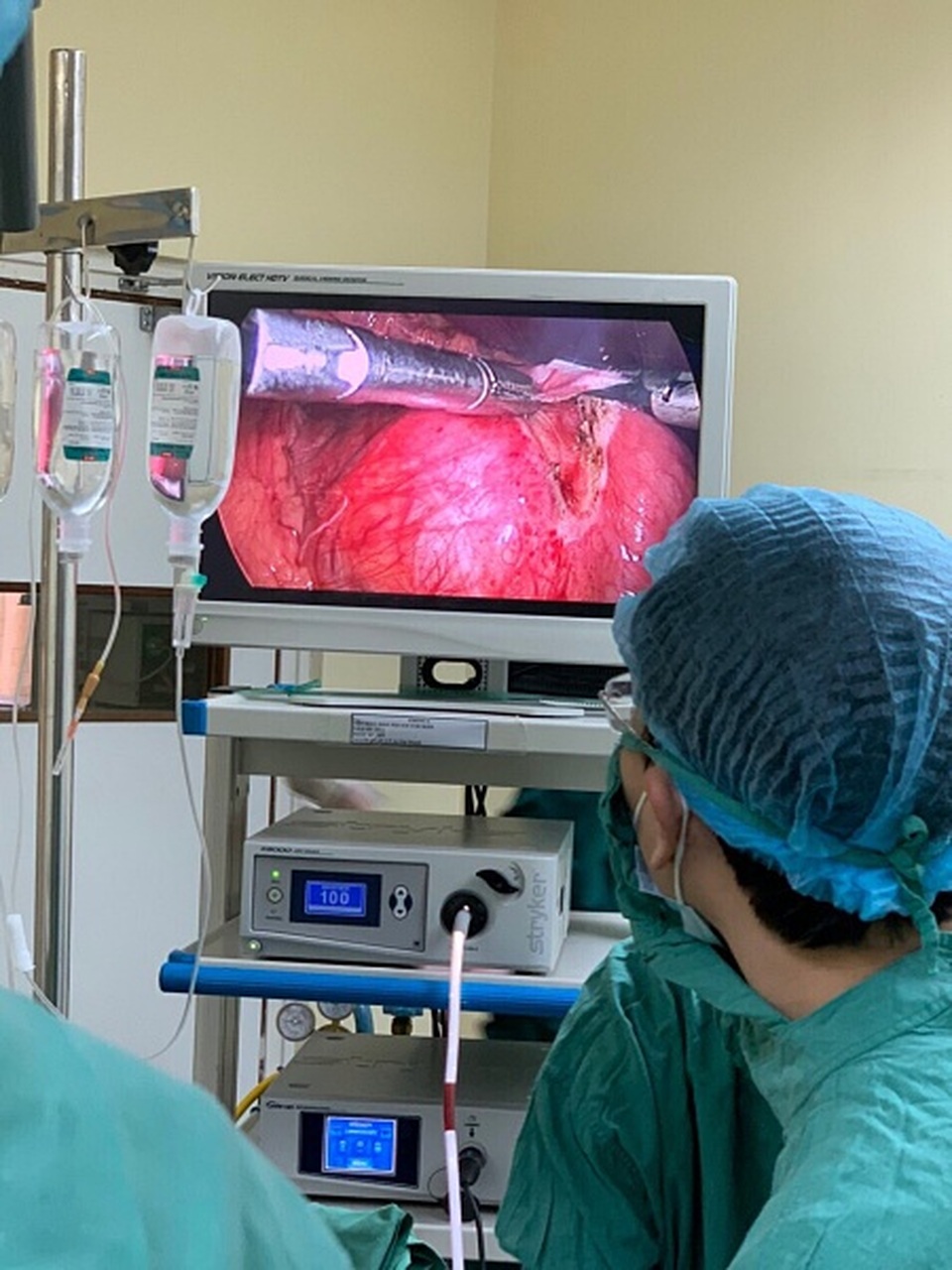 Bé gái 7 tuổi vô tình được phát hiện u quái trong bụng nhờ bị viêm phổi - 2 Bé gái 7 tuổi vô tình được phát hiện u quái trong bụng nhờ bị viêm phổi - 2