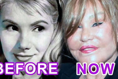 Jocelyn Wildenstein xưa và nay