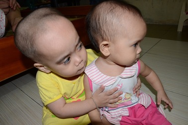 Thương 2 chị em mắc đa dị tật, suy giảm miễn dịch bẩm sinh