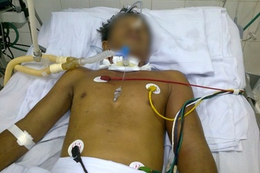 Một thợ giết mổ nguy kịch vì nhiễm liên cầu khuẩn lợn