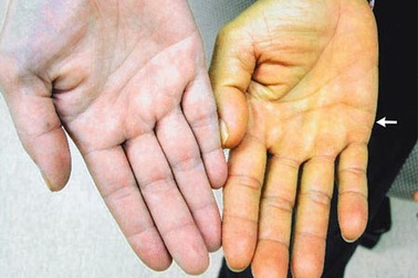 Lá gan “mát” cho làn da đẹp