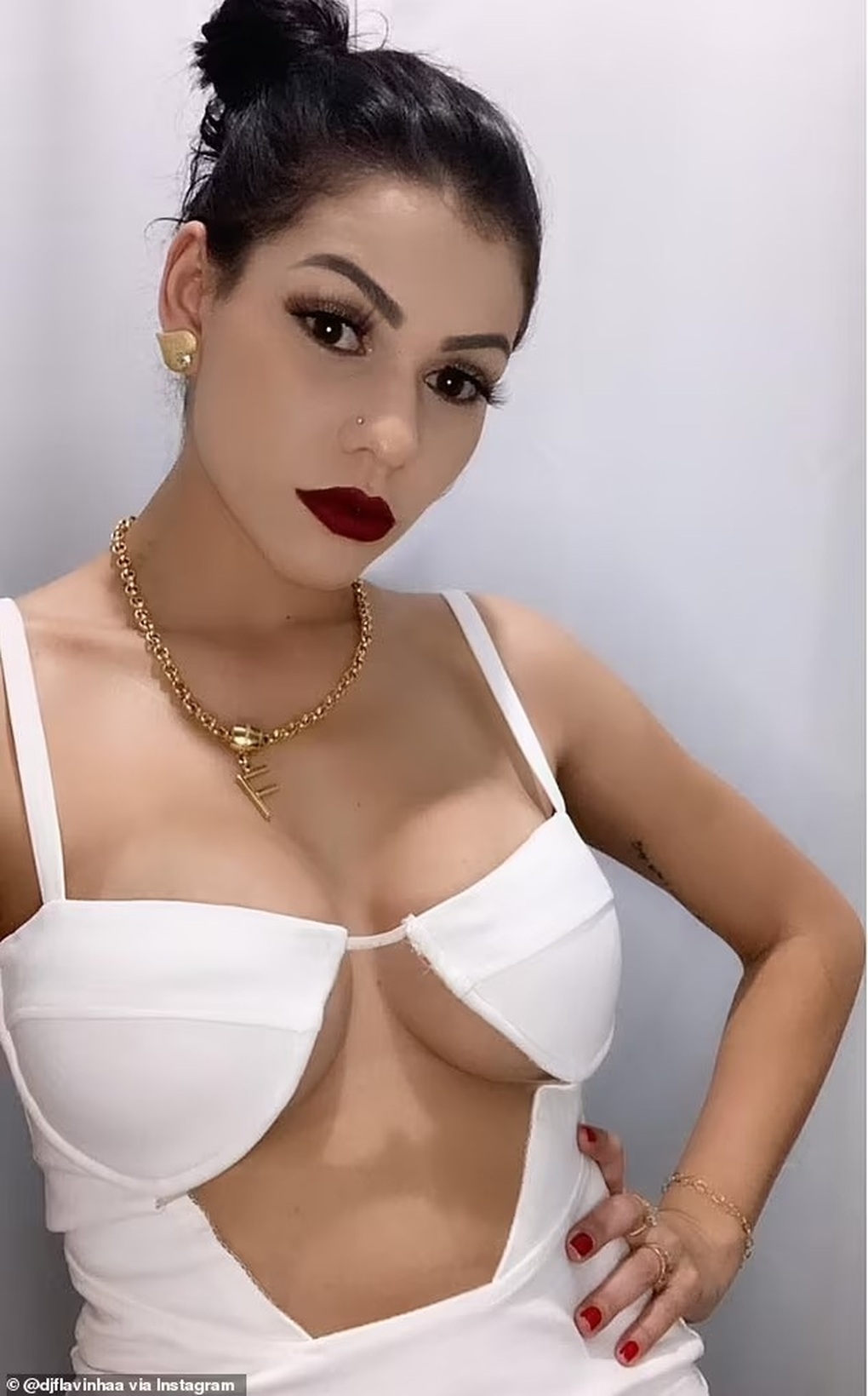 Nữ DJ bị bỏng vì cầm ngược súng bắn pháo giấy - 2 Nữ DJ bị bỏng vì cầm ngược súng bắn pháo giấy - 2