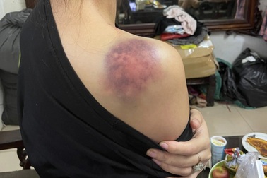 Người chồng bị tố tra tấn vợ "thừa sống thiếu chết" nêu phản bác gây choáng