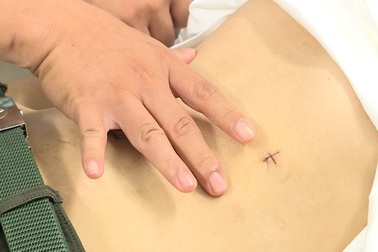 Chàng trai 19 tuổi loét ruột nguy kịch sau thời gian dài nghiện điện thoại