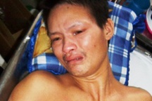 Số phận cay đắng của người đàn ông bị tai nạn xe máy