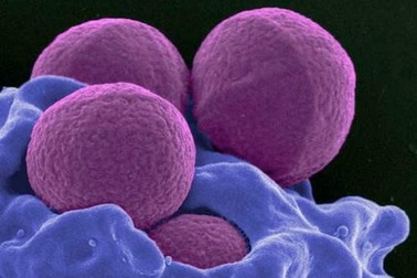 Số người chết vì siêu vi khuẩn sẽ vượt ung thư