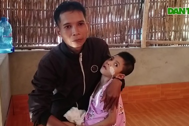 Bé gái 6 tuổi sống thực vật, cha mẹ nghèo nợ chồng chất