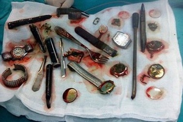 Trộm nuốt hàng loạt “chiến lợi phẩm” để phi tang vật chứng