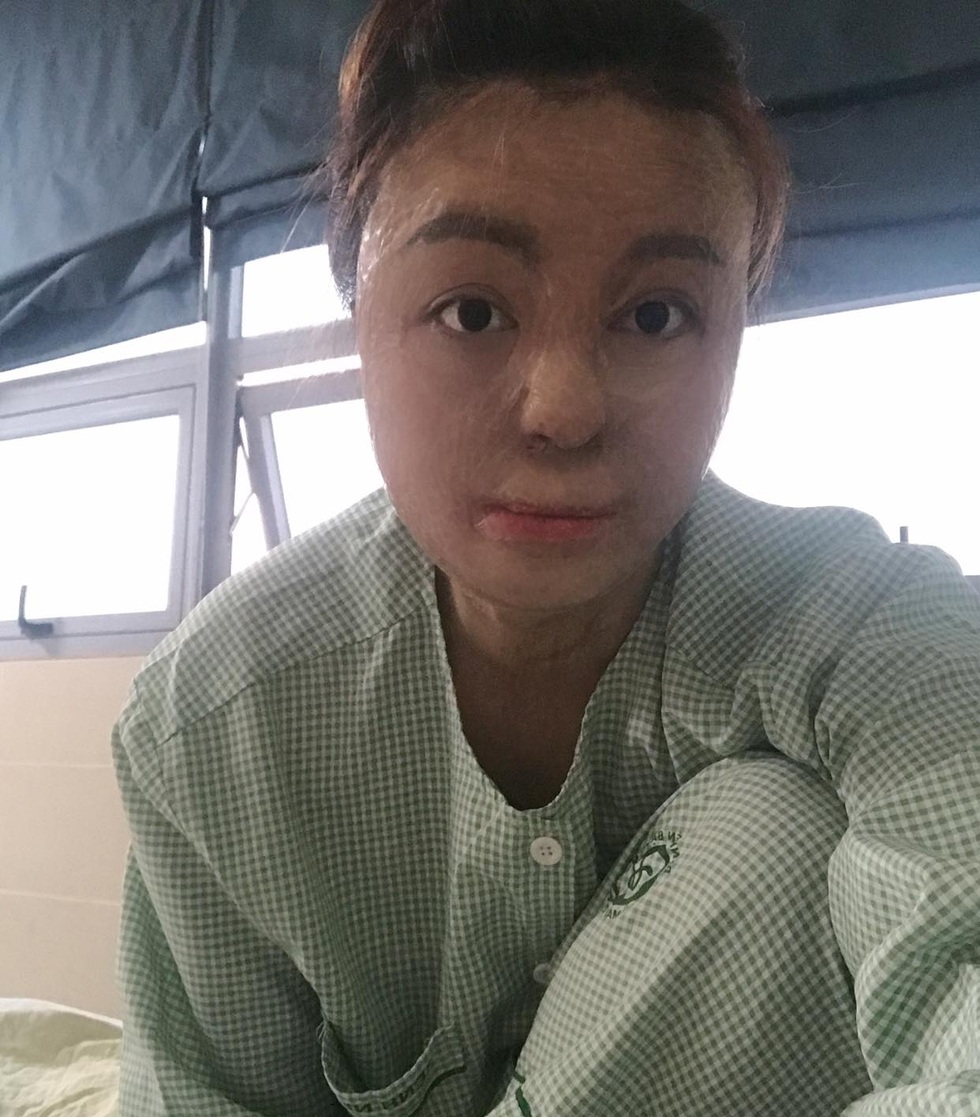 Hạnh phúc mới của cô gái Hà Nội bị chồng cũ tẩm xăng thiêu sống - 8 Hạnh phúc mới của cô gái Hà Nội bị chồng cũ tẩm xăng thiêu sống - 8