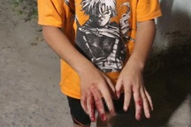 Cha đánh con chảy máu tay vì chơi game: Phương pháp giáo dục này có đúng?