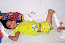 Cám cảnh gia đình cháu bé bị anh họ thiêu đốt