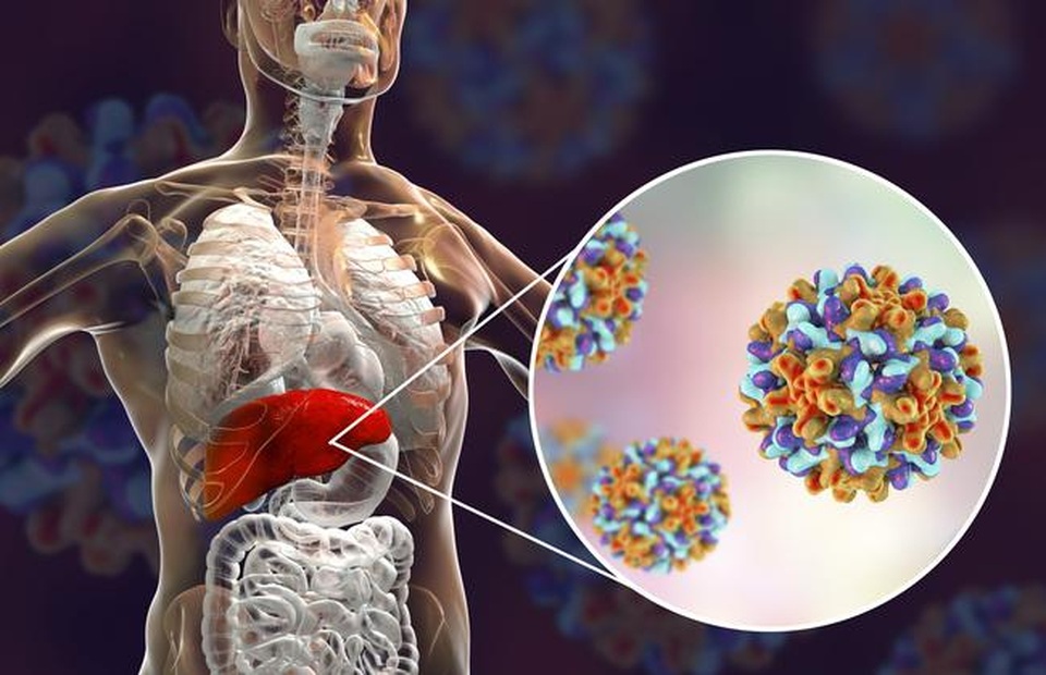Loại virus được gọi là kẻ giết người thầm lặng nhiều người Việt mắc phải - 1 Loại virus được gọi là kẻ giết người thầm lặng nhiều người Việt mắc phải - 1