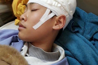 Tạm đình chỉ công tác thầy giáo bị phụ huynh tố tát học sinh gây chấn thương vùng đầu