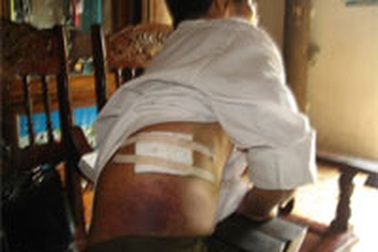 Một thầy giáo bị học sinh cũ đâm trọng thương