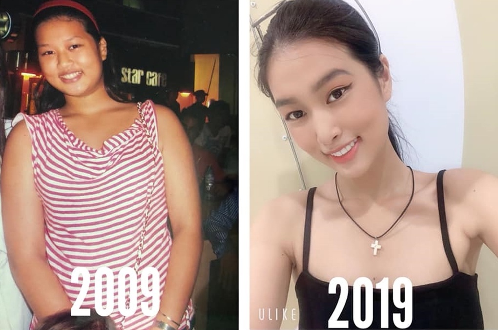 Tân Hoa hậu Thiên Ân: Từng nặng 75kg, bị rạn da vùng ngực vì giảm cân nhanh - 12 Tân Hoa hậu Thiên Ân: Từng nặng 75kg, bị rạn da vùng ngực vì giảm cân nhanh - 12
