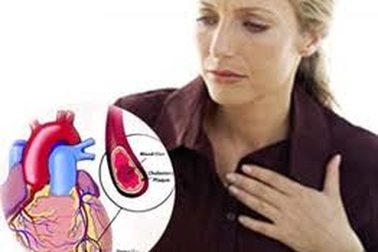 Những nhầm tưởng về nhồi máu cơ tim và đau tức ngực