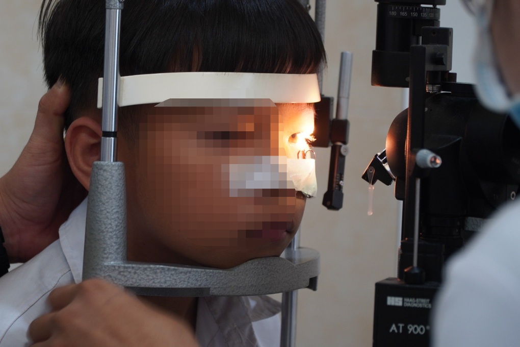 Cấp cứu bé trai 11 tuổi bị lưỡi câu sắc nhọn móc vào mắt khi đùa giỡn - 2 Cấp cứu bé trai 11 tuổi bị lưỡi câu sắc nhọn móc vào mắt khi đùa giỡn - 2