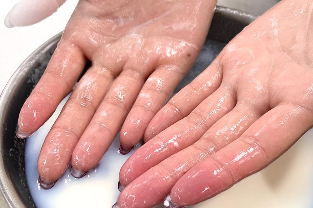 Cô gái 20 tuổi phải đi cấp cứu vì tai nạn bất ngờ khi làm món chân gà sả ớt - 1 Cô gái 20 tuổi phải đi cấp cứu vì tai nạn bất ngờ khi làm món chân gà sả ớt - 1