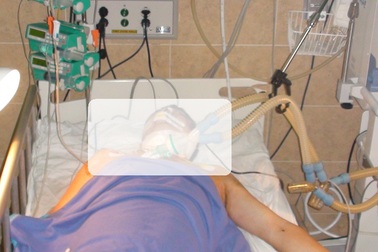 Cứu sống người đàn ông tự cứa cổ