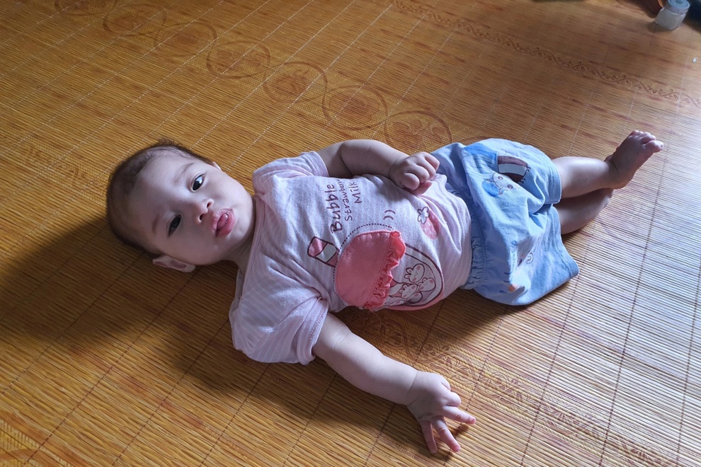 Nhói lòng cảnh bé gái 1 tuổi người mềm oặt, ngày lên cơn co giật mấy lần - 1 Nhói lòng cảnh bé gái 1 tuổi người mềm oặt, ngày lên cơn co giật mấy lần - 1