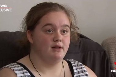 Cô bé 14 tuổi nhập viện vì nuốt phải kim trong táo mua siêu thị