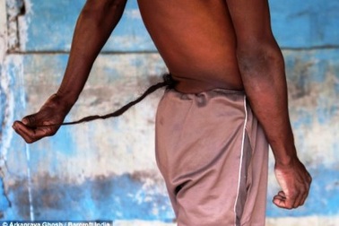 Người đàn ông có "đuôi" dài 37 cm 