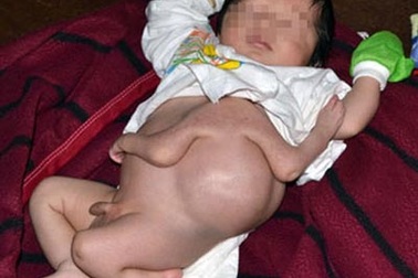 Sửng sốt những dị tật ở trẻ sơ sinh