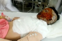 Bị nhân tình tạt a xít vì quyết chia tay