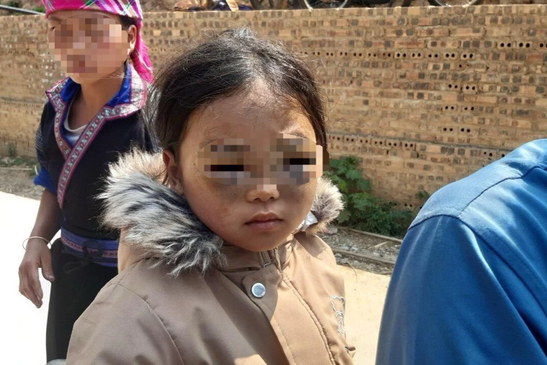 Tạm đình chỉ giáo viên nghi đánh bé gái lớp 1 thâm tím 2 mắt ở Yên Bái - 1