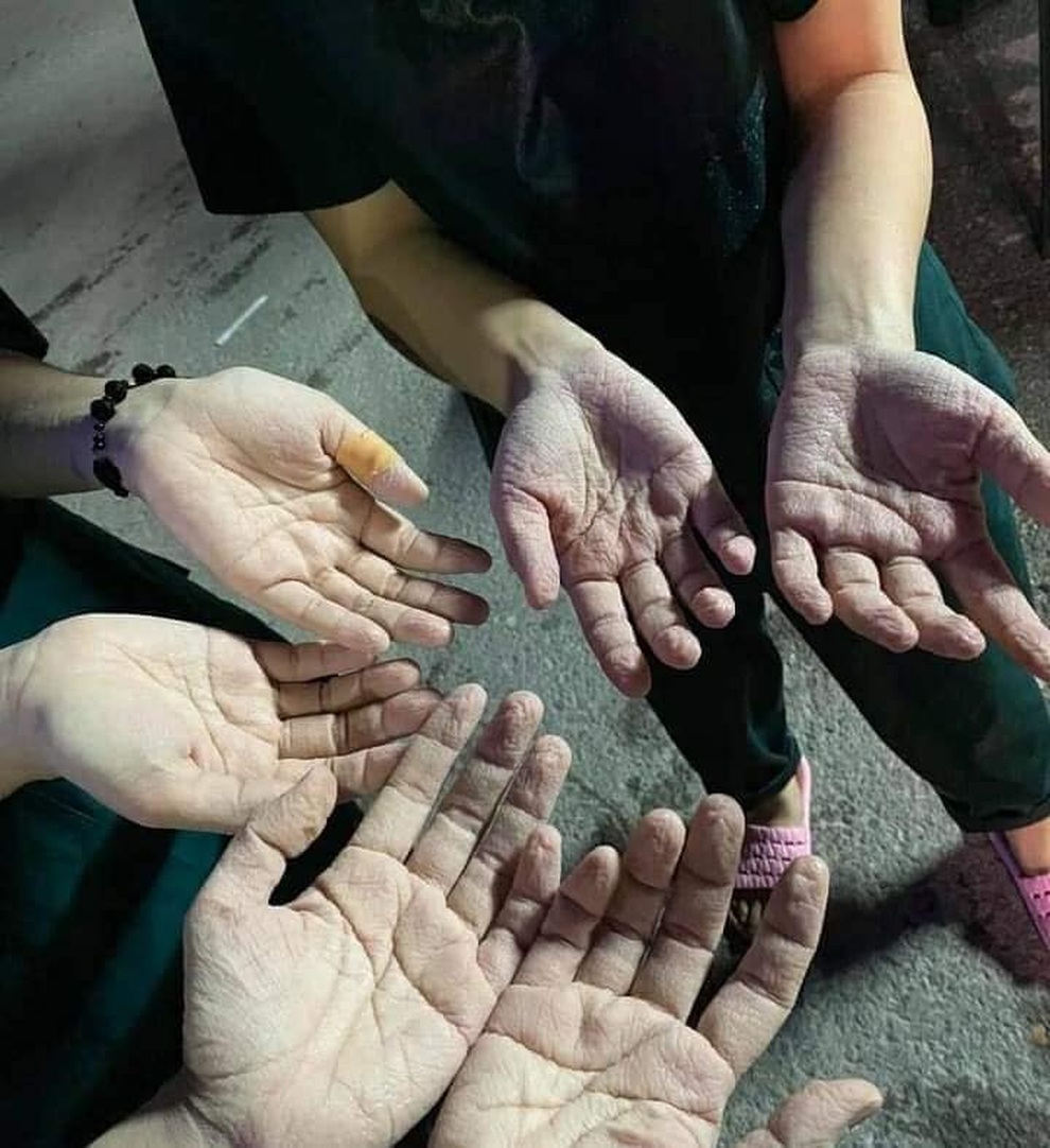 Những câu chuyện cảm động trong cuộc chiến chống dịch gây sốt dân mạng - 15