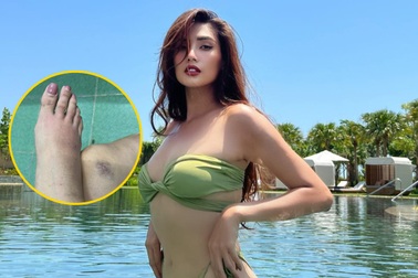 Siêu mẫu Võ Hoàng Yến bị thoái hóa khớp tuổi 35, việc catwalk ra sao?