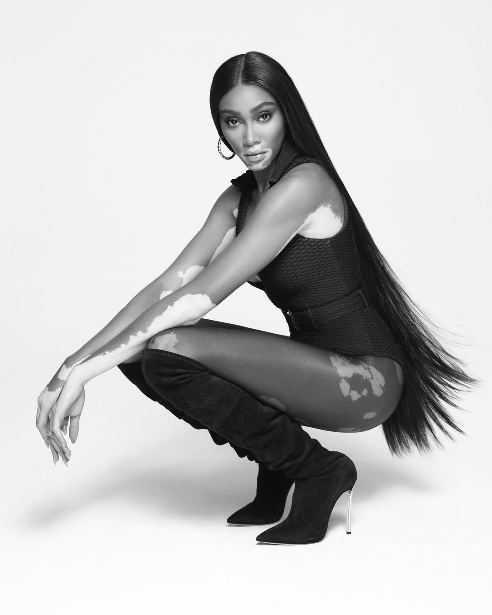 Siêu mẫu bạch biến Winnie Harlow mặc váy hở bạo đón tuổi 27 - 8 Siêu mẫu bạch biến Winnie Harlow mặc váy hở bạo đón tuổi 27 - 8
