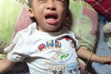 Bé 3 tuổi nguy kịch vì mắc bệnh u nguyên bào thần kinh