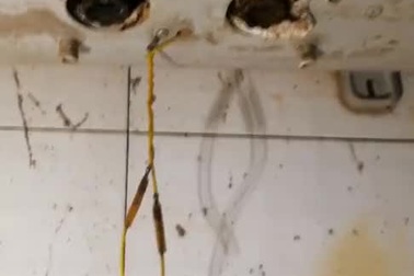 Bình nóng lạnh bất ngờ phát nổ khiến bé 17 tháng tuổi bị bỏng nặng