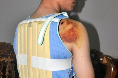 Yêu cầu làm rõ thông tin con trai bí thư xã đánh người nhập viện